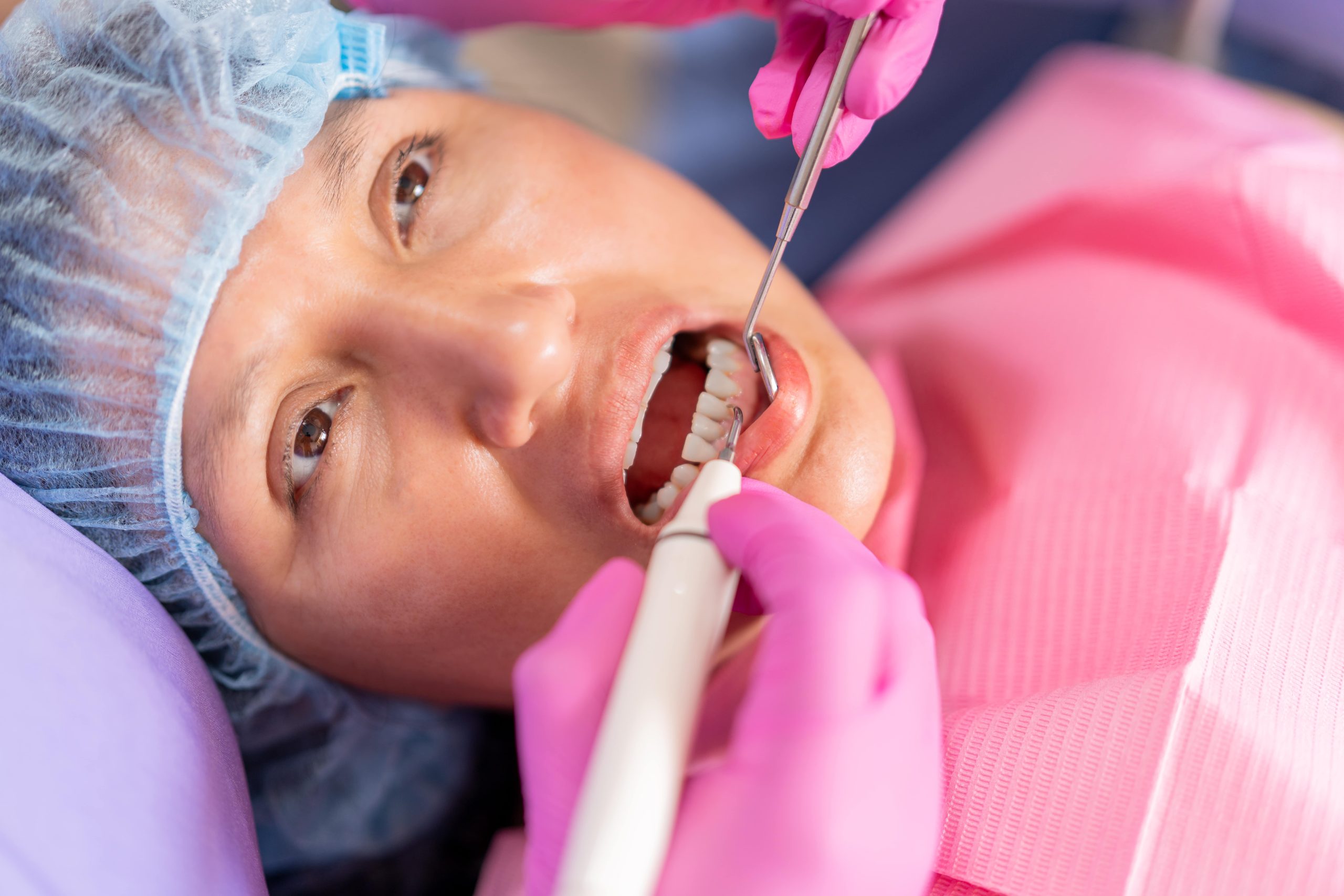 What is Periodontal Scaling?