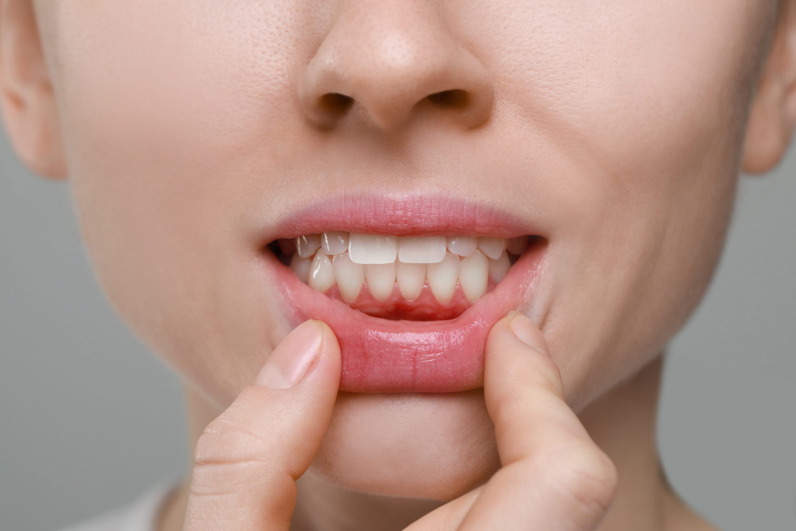Can Receding Gums Grow Back?