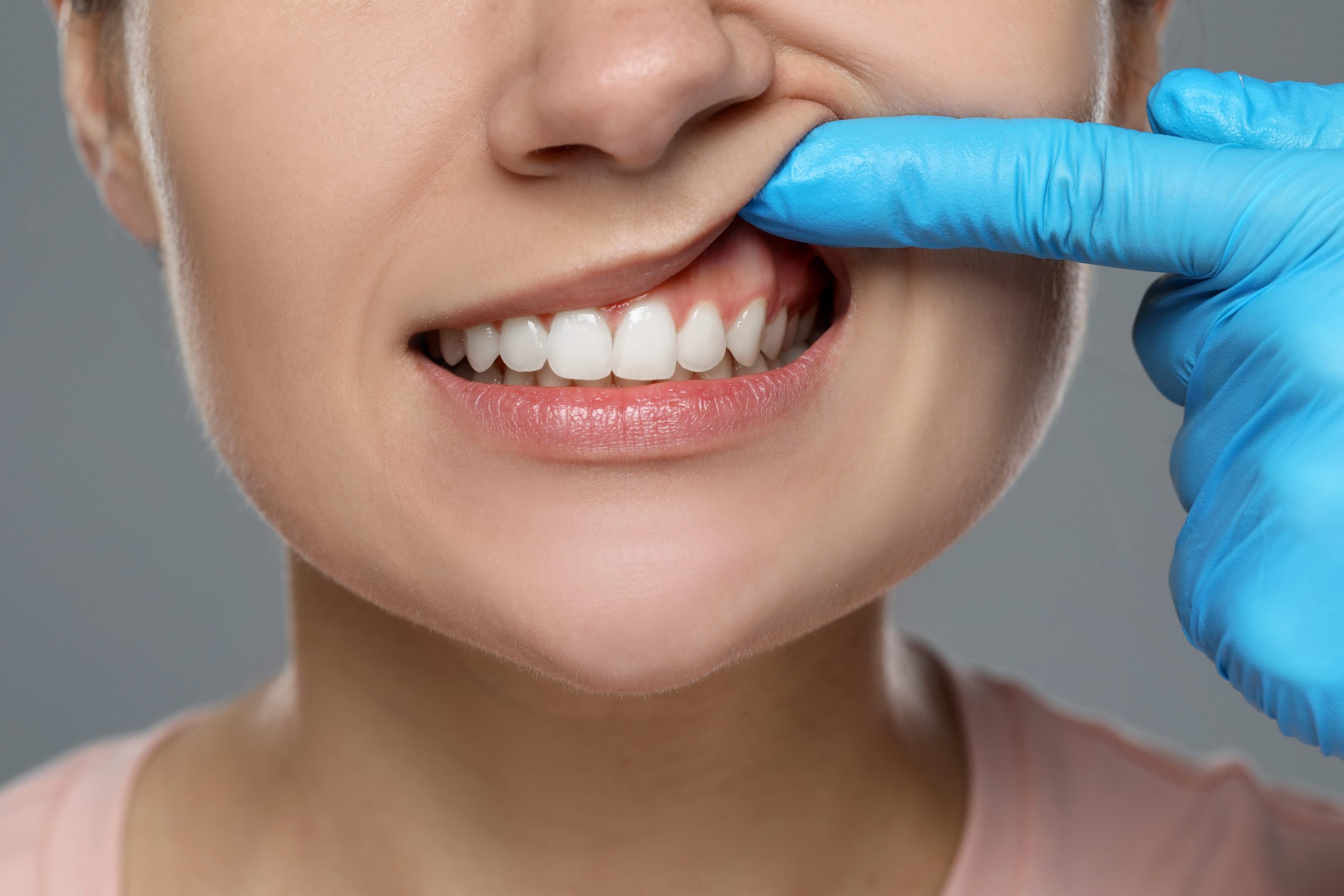 What Causes Gum Recession?